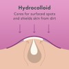 Rael Miracle Overnight Spot Cover - Parches hidrocoloides para espinillas