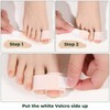 15 Pack Hammertoe Straightener, Reusable Broken Toe Wraps, Hammer Toe