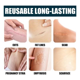 Crema Gel Reparador Cicatrices Acné Jaysuing 50ml Estrías