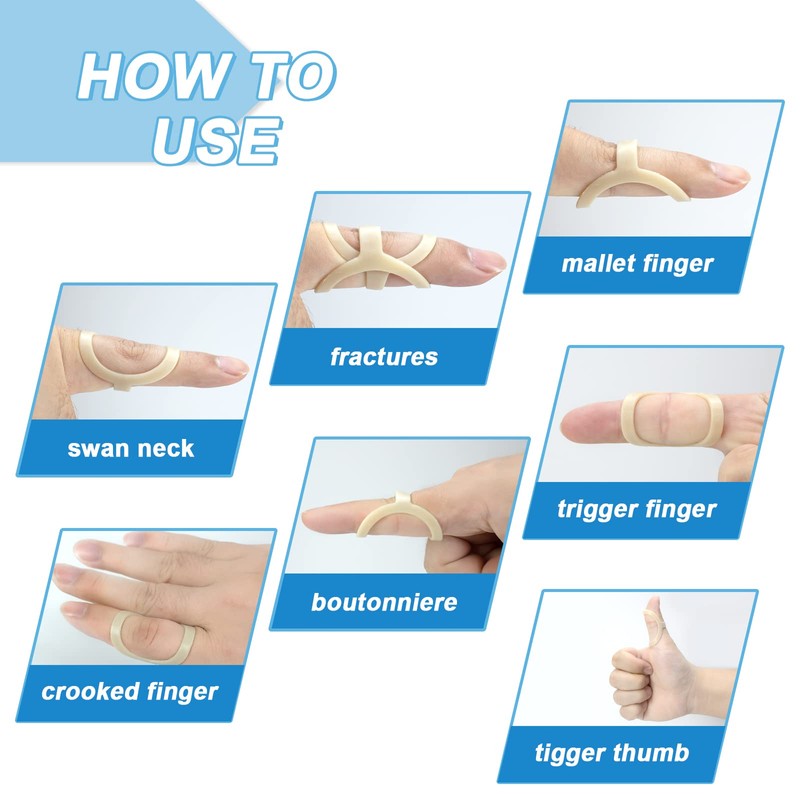 5Pcs Finger Splint, Trigger Finger Splint, Comfortable Trigger Finger Splint,