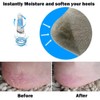 Codream Vented Moisturizing Socks Lotion Gel for Dry Cracked Heels,