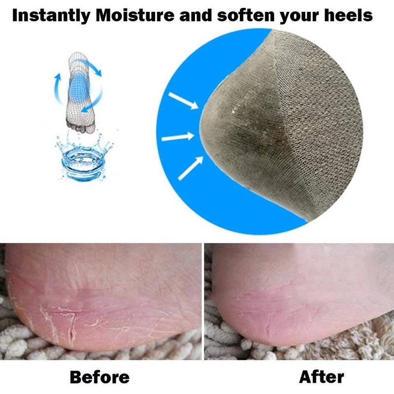 Codream Vented Moisturizing Socks Lotion Gel for Dry Cracked Heels,