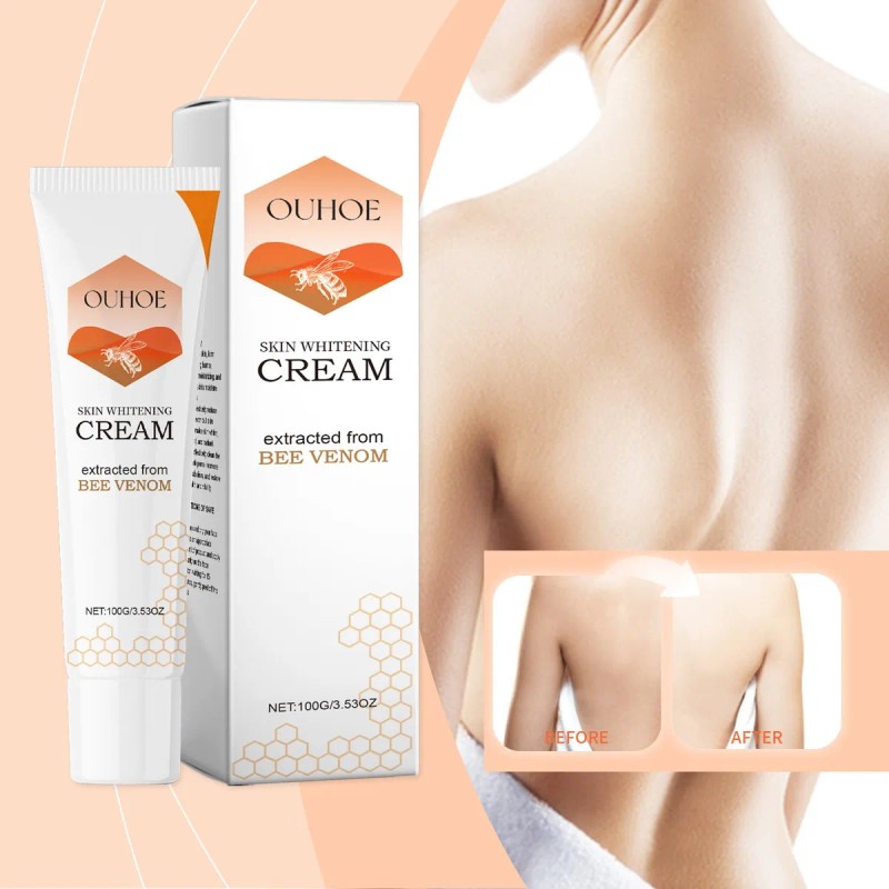 Crema Que Elimina La Melanina, Aclara El Tono Y Mejora