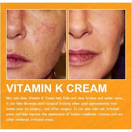 60g Crema para Venas Varicosas y Araas Vasculares, con Vitamina K, para Piernas, Unisex (1)