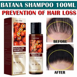 Champú y acondicionador de aceite Batana para el crecimiento del cabello humedad natural cabello suave EE. UU.