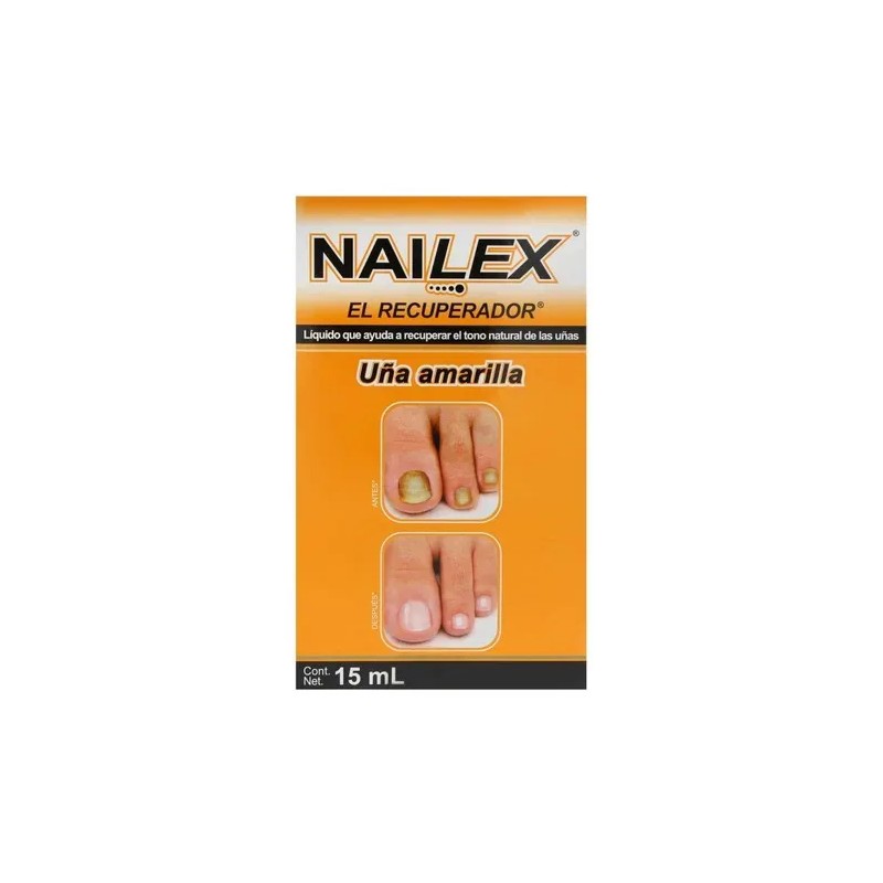 Nailex Líquido Recuperador De Tono Para Uña Amarilla 15ml Color
