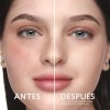 Cyzone - Skin First Sérum Anti Imperfecciones 19 Ml