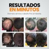 Henrys Fibras Capilares Negro 27.5g, Disimula Cabello Delgado, Aumenta Volumen