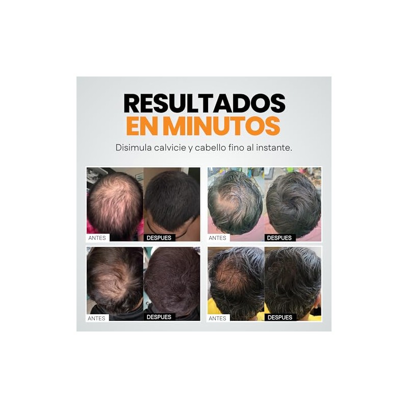 Henrys Fibras Capilares Negro 27.5g, Disimula Cabello Delgado, Aumenta Volumen