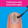 Excilor Micosi dell’unghia Forte, Trattamento della Micosi dell'Unghia Attivo Contro