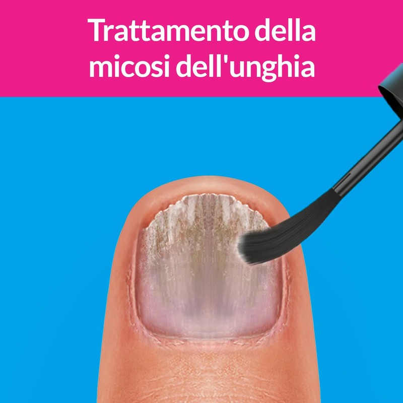 Excilor Micosi dell’unghia Forte, Trattamento della Micosi dell'Unghia Attivo Contro