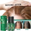 Unbranded Yao Pin Anti-Hair Loss & Hair Growth Solution Loss