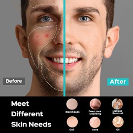 COSLUS Face Scrubber Facial Cleansing Brush: 5 Cleansing Modes Silicone Face Wash Scrubber for Men Beard Care, Sensitive Skin - Deep Cleansing​ & Gentle Exfoliating, Portable for Shower & Travel