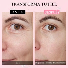Suero Retinol Anti-envejecimiento Rejuvenece Piel Manchas Todo Tipo De Piel Día/noche