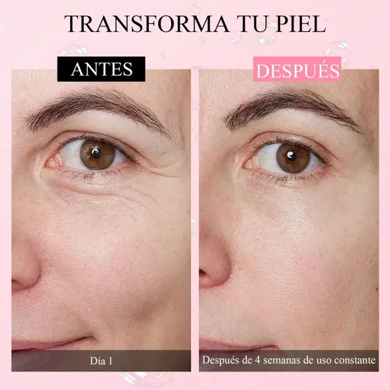 Suero Retinol Anti-envejecimiento Rejuvenece Piel Manchas Todo Tipo De Piel