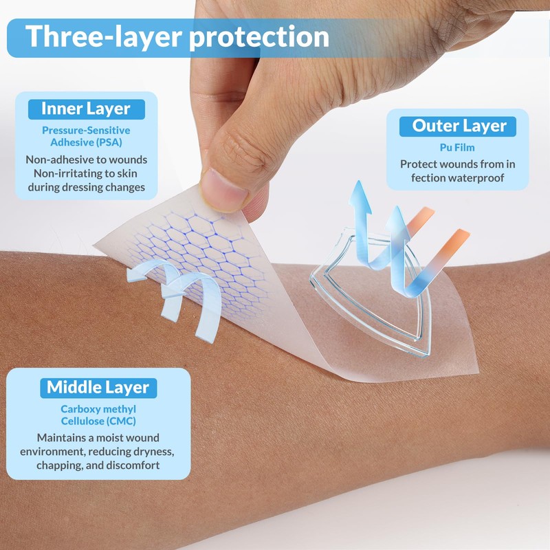 Hydrocolloid Bandage Roll, 2in x 5ft