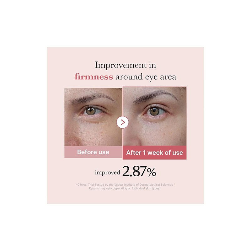 MEDICUBE [MEDICUBE]PDRN Pink Eye Serum 30ml