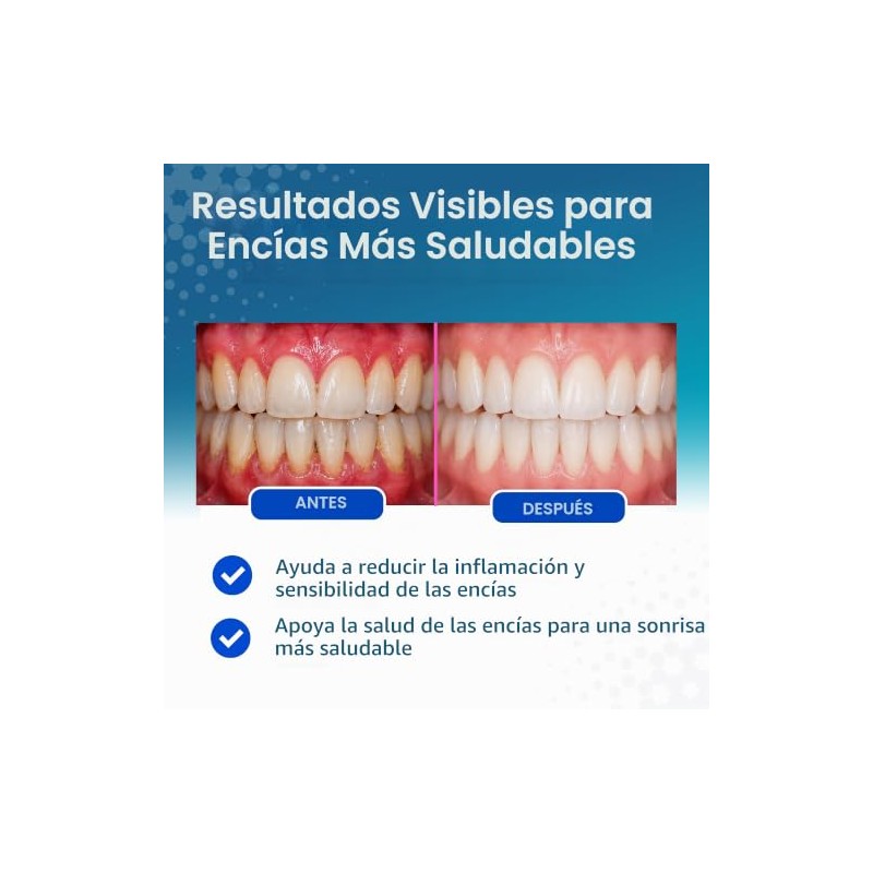 VITIS Gingival Toothpaste 100ml - daily care for sensitive gums
