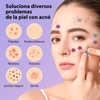 🌿✨ Parches para Acné | 240 Pcs Almohadillas Hidrocoloides |