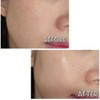 Fury Young Puriyoung Pure Balance Control Booster 50ml Pore Trouble