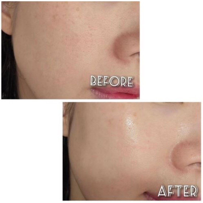 Fury Young Puriyoung Pure Balance Control Booster 50ml Pore Trouble