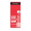 Neutrogena Stubborn Acne Spot Drying Lotion, Fragrance-Free Sulfur Acne Treatment