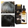 Suero Tratamiento De Las Canas, Unisex, Color Natural