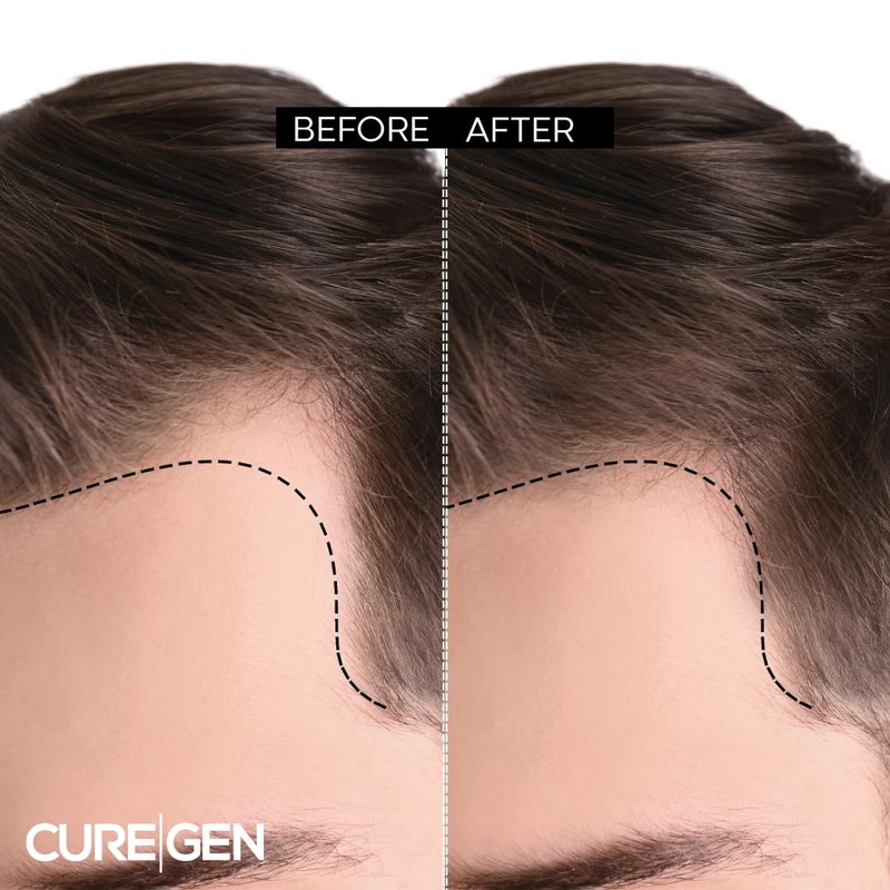 Curegen Hair Serum
