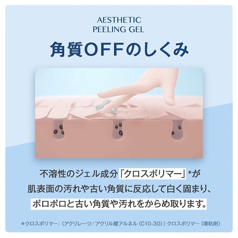 TBC esutetexikkupi-ringujeru