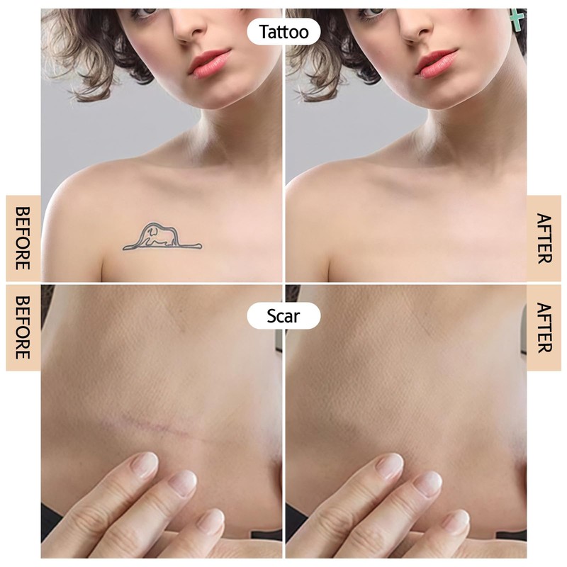 Prreal 8Pcs Tattoo Cover Up Patch, Natural Looking Cover up