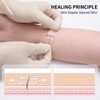 Emergency Wound Closure Device, 4 Pcs Butterfly Bandaids Closure Zippers,