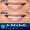 Teeth Whitening Strips – Non-Sensitive Teeth Whitening Stickers, 10 Packs