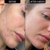 The INKEY List SuperSolutions Novoretin 2% Moisturizer, Skin Clearing Moisturizer
