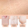 Silicone Patches for Stretch Marks, Anti Wrinkle Stretch Removal Sheet
