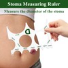 Ostomy Caliper Measuring Tool for Measuring Stomy Diameter Nurse or