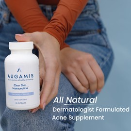 Hormonal Acne Treatment for Women - No DIM - (60 Capsules, 485 mg) – DIM-Free Acne Medication - Helps Nodular & Hormonal Acne - Best Acne Treatment for Teenagers & Adults
