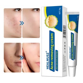 Gel Facial Anti-piel Acne Para Todo Tipo De Piel 20g                                                                                                  