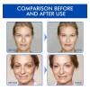 Sérum Facial De Efecto Instantáneo Para Dar Volumen Y Firmez
