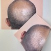3PCS/Pack Scalp Micropigmentation Practice Skin – Printed SMP Tattoo Training