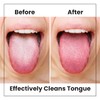 Lindo Eco-Friendly Tongue Cleaners, Tongue Scrapers, Oral Care Cleaners, Reduce