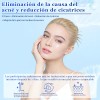Acne Buster Loción Secante Con Ácido Salicílico 10ml
