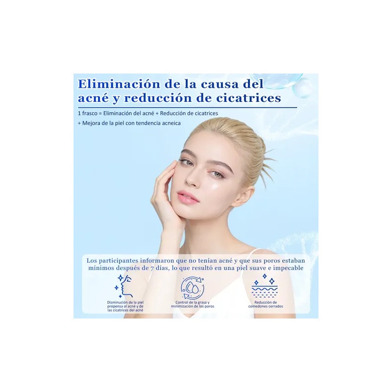 Acne Buster Loción Secante Con Ácido Salicílico 10ml