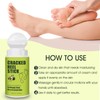 Cracked Foot Cream Roll-On Moisturizer, 1.76floz