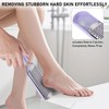 Beomeen Large Foot File Callus Remover for Feet 3 in