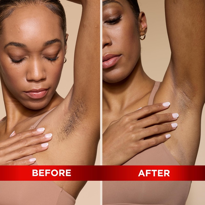 SoftSheen-Carson Magic Razorless Shaving Cream, Depilatory Hair Removal Cream for