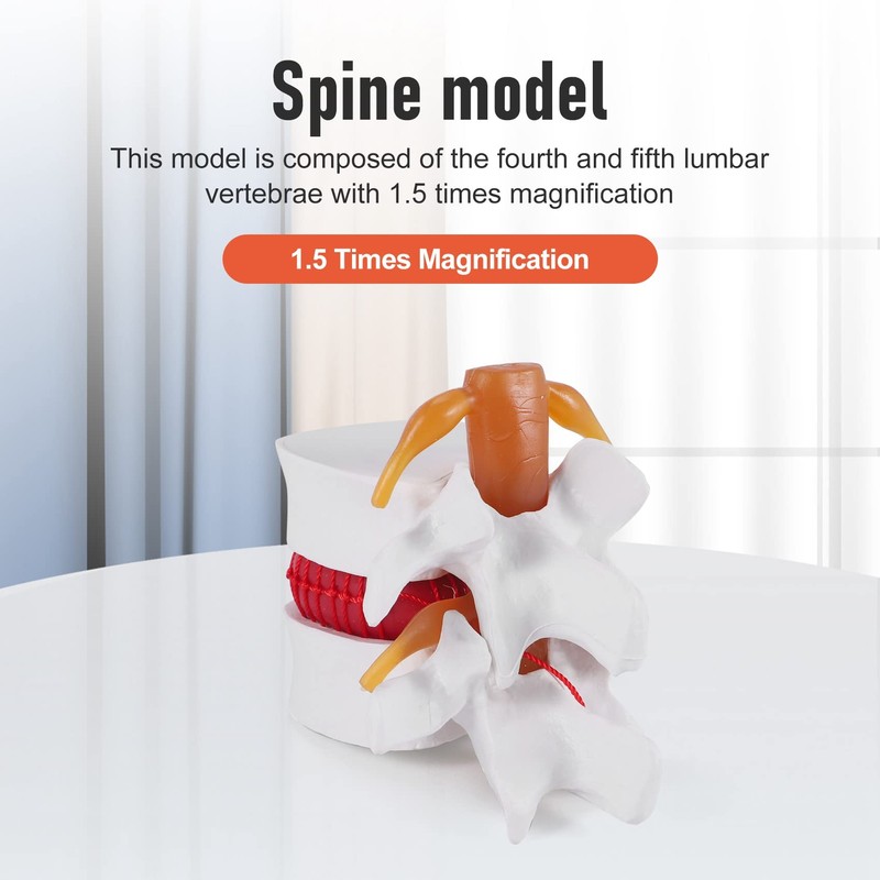 TOBEOME 1:1.5 Human Demonstration Model for Herniated Disc of the