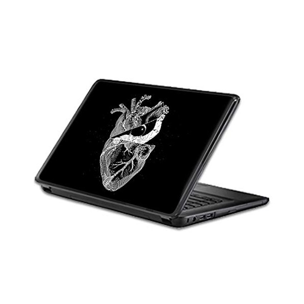 Universal Fit MightySkins Skin Compatible with Any 15" Screen Laptop