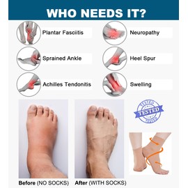 2 Pairs Ankle Brace Medical Compression Socks Women & Men 20-30 mmhg, Support Stockings, Bandage Ankle Bandage for Swelling Heel Spurs Sprain Sports (Black + Beige, M)