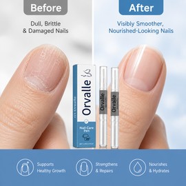 4-Pack Nail Repair Serum Pens for Toenail Care – Moisturizing Nail Nutrient Pens for Daily Grooming