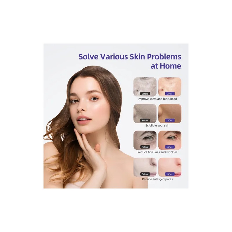 Maquina De Dermoabrasion 3 En 1 Diamond Microdermoabrasion